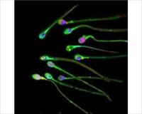 Erkeklerin ömrünü sperm yiyor